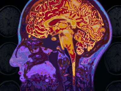 Et menneske fra siden og et røgen billede af hjernen, menneske skikkelsen er lilla og hjernen lyser op i orange farver - for at sætte fokus på menneske hjernen